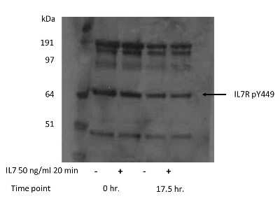 Western Blot: IL-7R alpha/CD127 [p Tyr449] Antibody [NB110-85537]